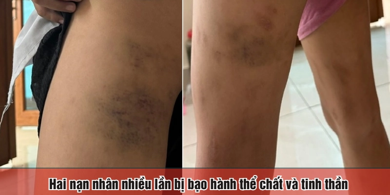 Hai nạn nhân nhiều lần bị bạo hành thể chất và tinh thần