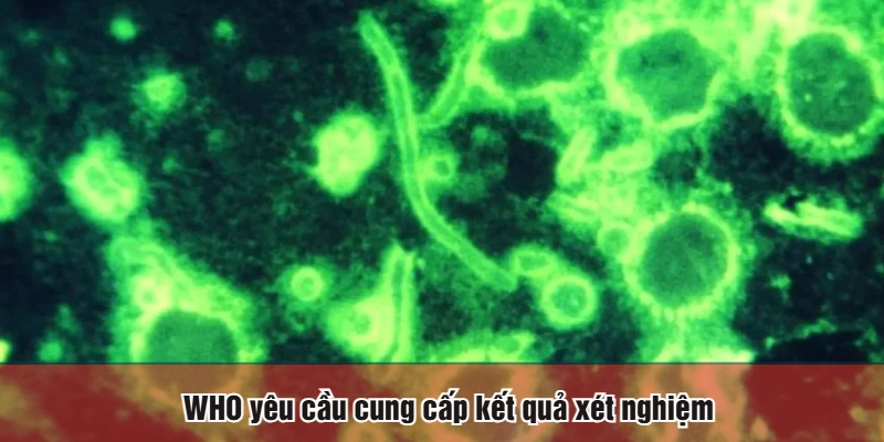 WHO yêu cầu cung cấp kết quả xét nghiệm